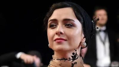 بیماری ترانه علیدوستی چیست؟ / نگاهی به سندرم نادر DRESS و پیامدهای آن