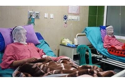 سوختگی در ایران؛ از بحران کمبود تخت تا هزینه‌های گزاف درمان