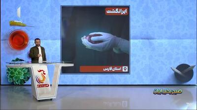  نخستین عمل پیوند کبد در شهر تاریخی بخارا + فیلم