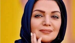  تغییر چهره الهام پاوه‌نژاد در این عکس جلب توجه کرد