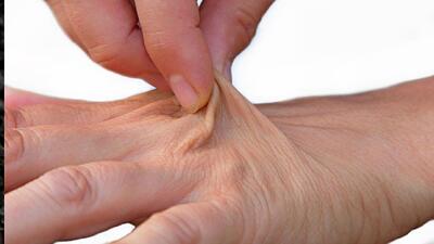  یک اشتباه تغذیه‌ای که پوست را پیر می‌کند