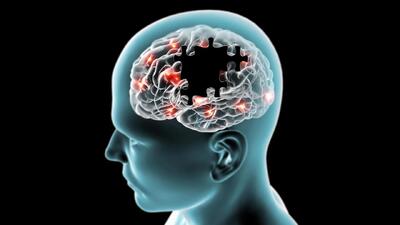 کشف متهم جدید آلزایمر و دارویی که پیش از آغاز فراموشی وارد عمل می‌شود