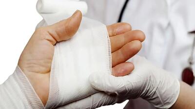 ایران در صدر جدول سوختگی جهان / بلای خانگی که سالانه ۳ هزار ایرانی را می‌کشد