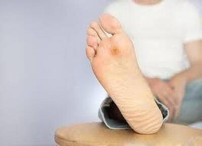  بی‌دردی زخم در افراد دیابتی نشانه چیست؟