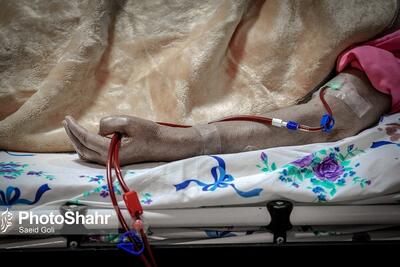 دسترسی سخت بیماران هموفیلی به درمان در سایه تحریم‌ها