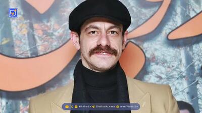 گریم جالب و غیرقابل باور محمد شعبانپور/ بازیگر سریال شیش ماهه تغییر چهره داد