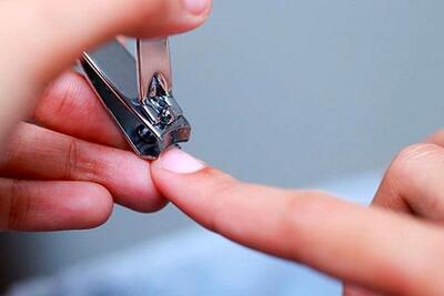 اگر این علایم غیر طبیعی روی ناخن دیدید نگران شوید