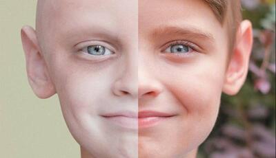 اجرای پایلوت «پیشگیری از سرطان‌های ارثی» در کشور