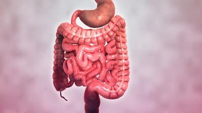 آیا بیماری کرون نیازی به جراحی دارد؟