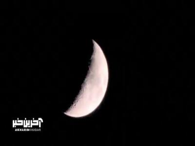  اگر چه درد بسیار است اما تا تو درمانی