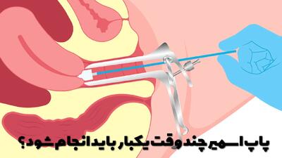  پاپ اسمیر چند وقت یکبار باید انجام شود؟ چند روز قبل از پاپ اسمیر نباید رابطه داشت؟