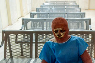  قیمت لباس سوختگی رکورد زد