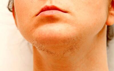 رشد موهای زائد در ۴۰ و ۵۰ سالگی، راه‌حل چیست؟