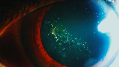  بیماری نادری که چشم‌ها را مانند درخت کریسمس درخشان می‌کند | گیمفا