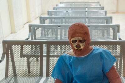 پوشش بیمه‌ای پانسمان‌های نوین سوختگی/هزینه‌های گزاف داروها و لباس‌های سوختگی