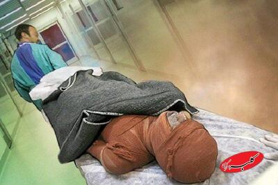  کمبود هزار تخت بیمارستانی سوختگی در کشور - کلبه سرگرمی