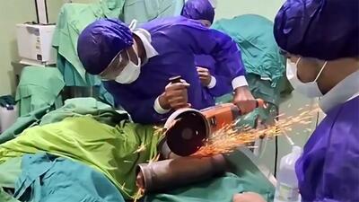 فیلم گیر کردن دست مرد جوان در چرخ گوشت / صحنه دردناک مقابل چشم آتش نشانان