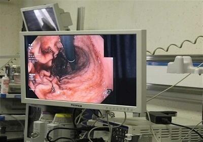 بیماری‌های گوارشی در کودکان - تسنیم