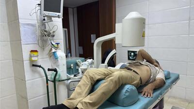 همه چیز درباره سنگ شکن کلیه!