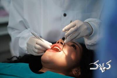 دلیل شیوع بالای پوسیدگی دندان در ایرانی‌ها چیست؟ | این گروه حتی یک دندان هم در دهان‌شان نمانده است - مجله اینترنتی کولاک