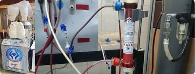  ساخت نمونه آزمایشگاهی ریه مصنوعی با استفاده از فیلتر‌های همودیالیز