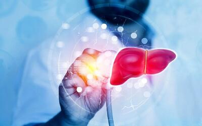  ۵ نشانه روی صورت که خبر از کبد چرب می‌دهند!