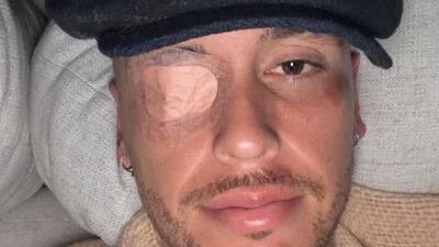 ستاره آرژانتینی لالیگا با فلج صورت درگیر شد