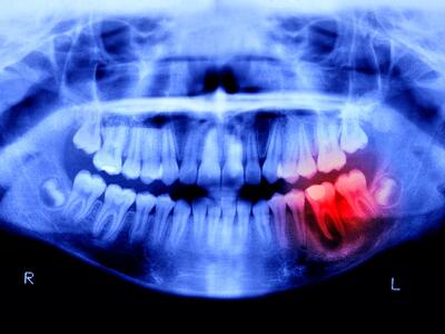 انسان‌ها تا ۴ سال آینده می‌توانند دندان‌های جدید رشد دهند | گیمفا