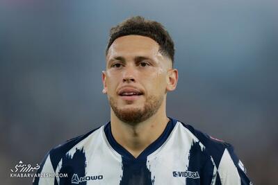 صورت این ستاره فلج شد! +عکس