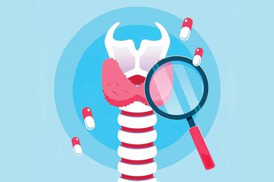 کم کاری تیروئید؛ بیماری‌ای که دیر تشخیص داده می‌شود و عوارض زیادی برجا می‌گذارد | سایه سنگین یک کم‌کاری