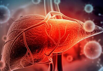 ۵ نشانه روی صورت که فریاد می‌زند کبدتان چرب است