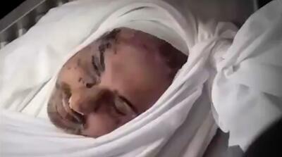 تصاویر پیکر ابوعبیده سخنگوی حماس پس از ترور