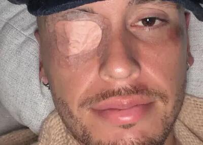 ستاره آرژانتینی از ناحیه صورت فلج شد!