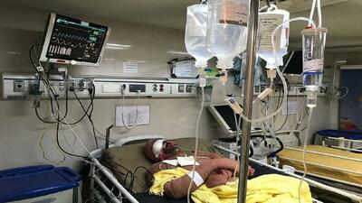 درمان سوختگی با روش‌های سنتی و دارو‌های محلی، علمی نیست + فیلم