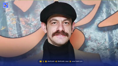  گریم جالب و غیرقابل باور محمد شعبانپور/ بازیگر سریال شیش ماهه تغییر چهره داد
