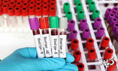 این گروه خونی بیشتر مریض می‌شود - مجله اینترنتی کولاک