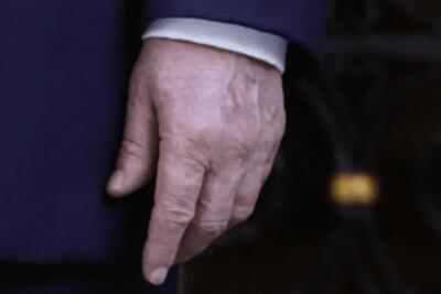 شایعات درباره وضعیت سلامتی ترامپ دوباره داغ شد | تصاویر دست چپ خبرساز شد