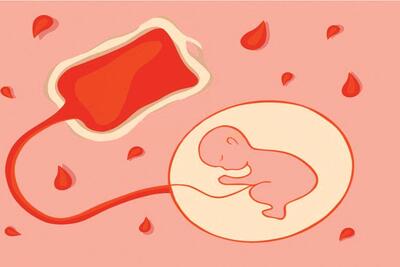 فرصت ها و چالش های ذخیره خون بند ناف در  پزشکی نوین | بیمه حیات پشت دیوار بی‌پولی