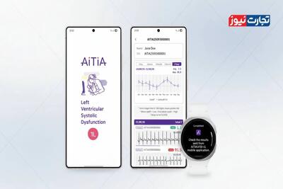 انقلاب پزشکی سامسونگ با سرویس سلامت مغز