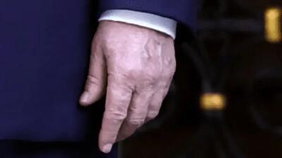 شایعات در مورد سلامتی ترامپ،‌ دوباره بالا گرفت