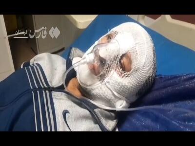  ایستادگی پلیس کوهدشت در آتش اغتشاشگران