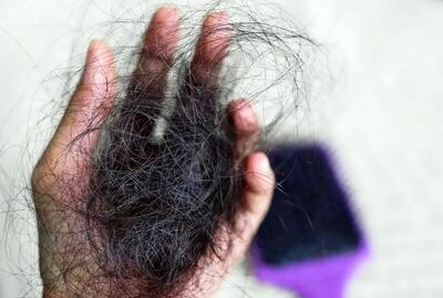 چرا موها در بارداری پرپشت می‌شوند و بعد از زایمان می‌ریزند؟