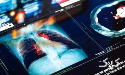 زنگ خطر برای یک فاجعه قریب‌الوقوع | لنست از آمار هولناک خبر داد؛ احتمال مرگ ۱۸.۶ میلیون نفر در سال - مجله اینترنتی کولاک