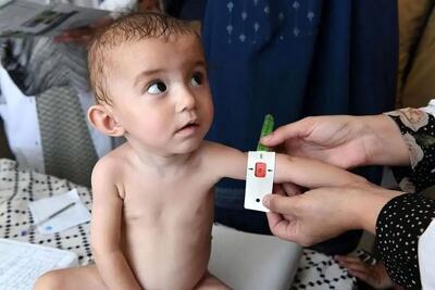 واریز دو مرحله یارانه رفع سوءتغذیه کودکان زیر ۵ سال