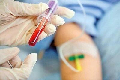 نیاز سالانه کشور به یک‌ونیم میلیون لیتر پلاسما