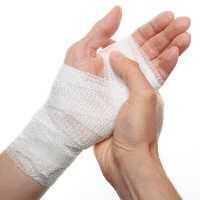 فیزیوتراپی؛ راز درمان سریع بیماران سوختگی! / چگونه به بازتوانی و کاهش درد کمک می‌کند / نکات ضروری برای پزشکان و بیماران