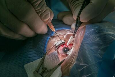 گسترش خدمات دندانپزشکی چندتخصصی برای بیماران غرب تهران