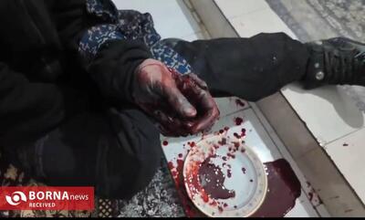  انفجار نارنجک دستی در ملارد؛