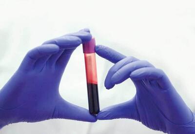  راز طول عمر در خون