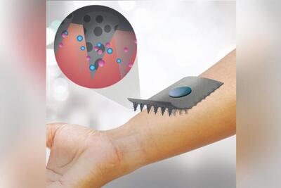  برچسب عرق کره جنوبی قند خون را بدون هیچ سوزنی کنترل می کند